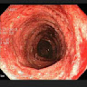 Meet your Posher, Ayceue